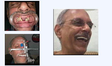 Top dentist in Hyderabad