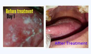 Snoring treatment Doctor