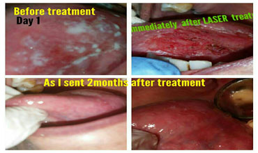 Best dental hospital in Hyderabad