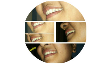 Best dentist in Hyderabad