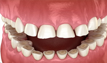 Top dentist in Hyderabad